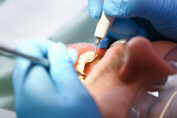 Best Pediatric Emergency Dentist in Maysville, GA