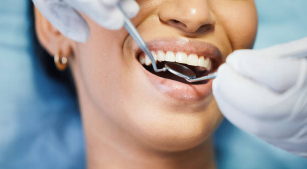 Best Emergency Denture Repair in Maysville, GA