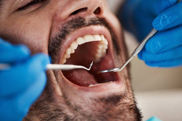 Best Emergency Gum Treatment in Maysville, GA