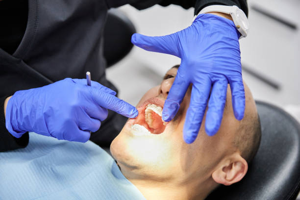 Best Urgent Care for Lost Fillings or Crowns in Maysville, GA